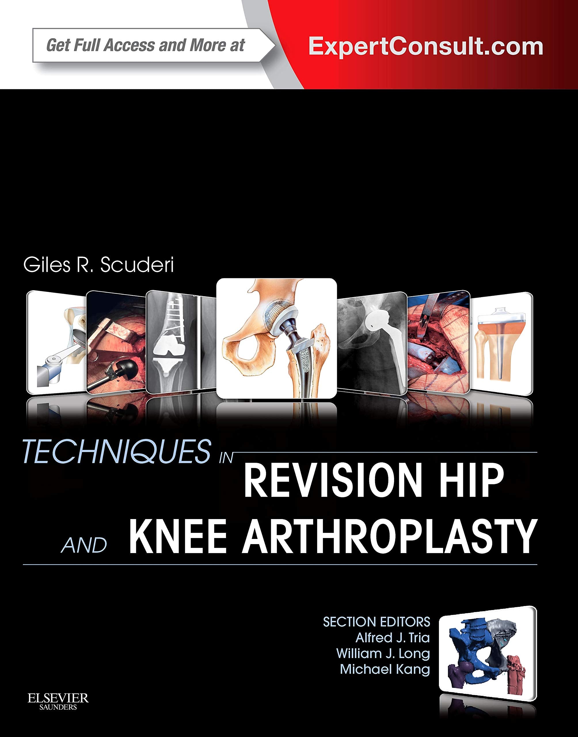 Techniques In Revision Hip And Knee Arthroplasty