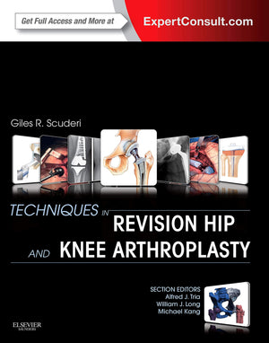 Techniques In Revision Hip And Knee Arthroplasty