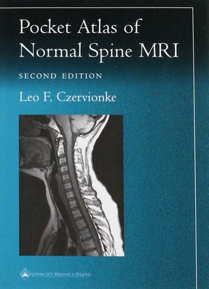 Pocket Atlas Of Spinal Mri (Radiology Pocket Atlas Series)