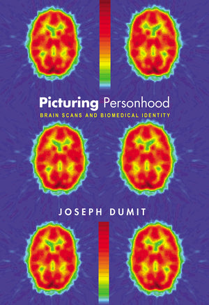 Picturing Personhood: Brain Scans and Biomedical Identity (InFormation),Used