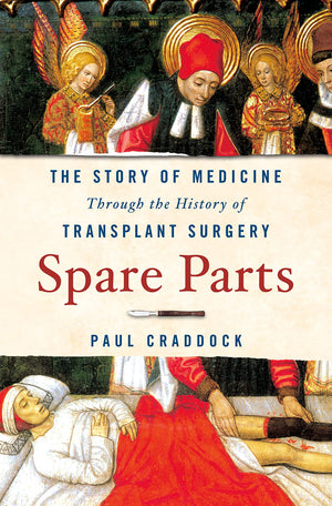 Spare Parts: The Story Of Medicine Through The History Of Transplant Surgery-new