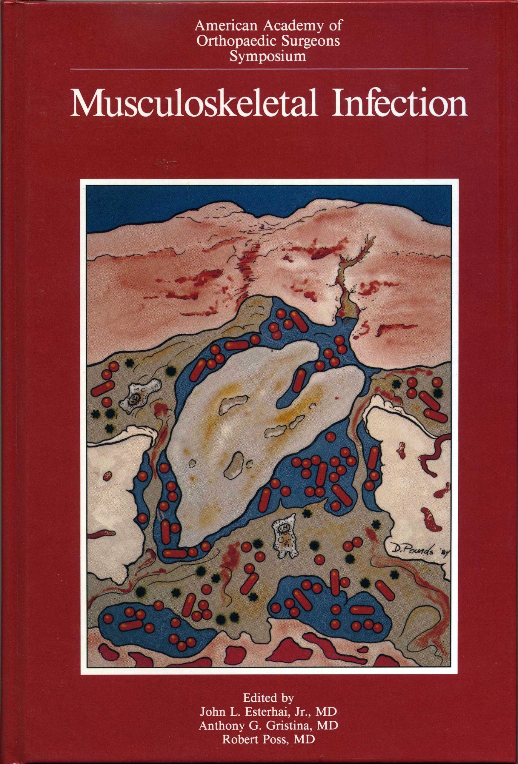 Musculoskeletal Infection (American Academy of Orthopaedic Surgeons Symposium),Used