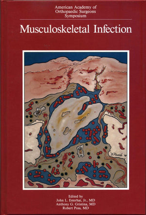 Musculoskeletal Infection (American Academy of Orthopaedic Surgeons Symposium),Used