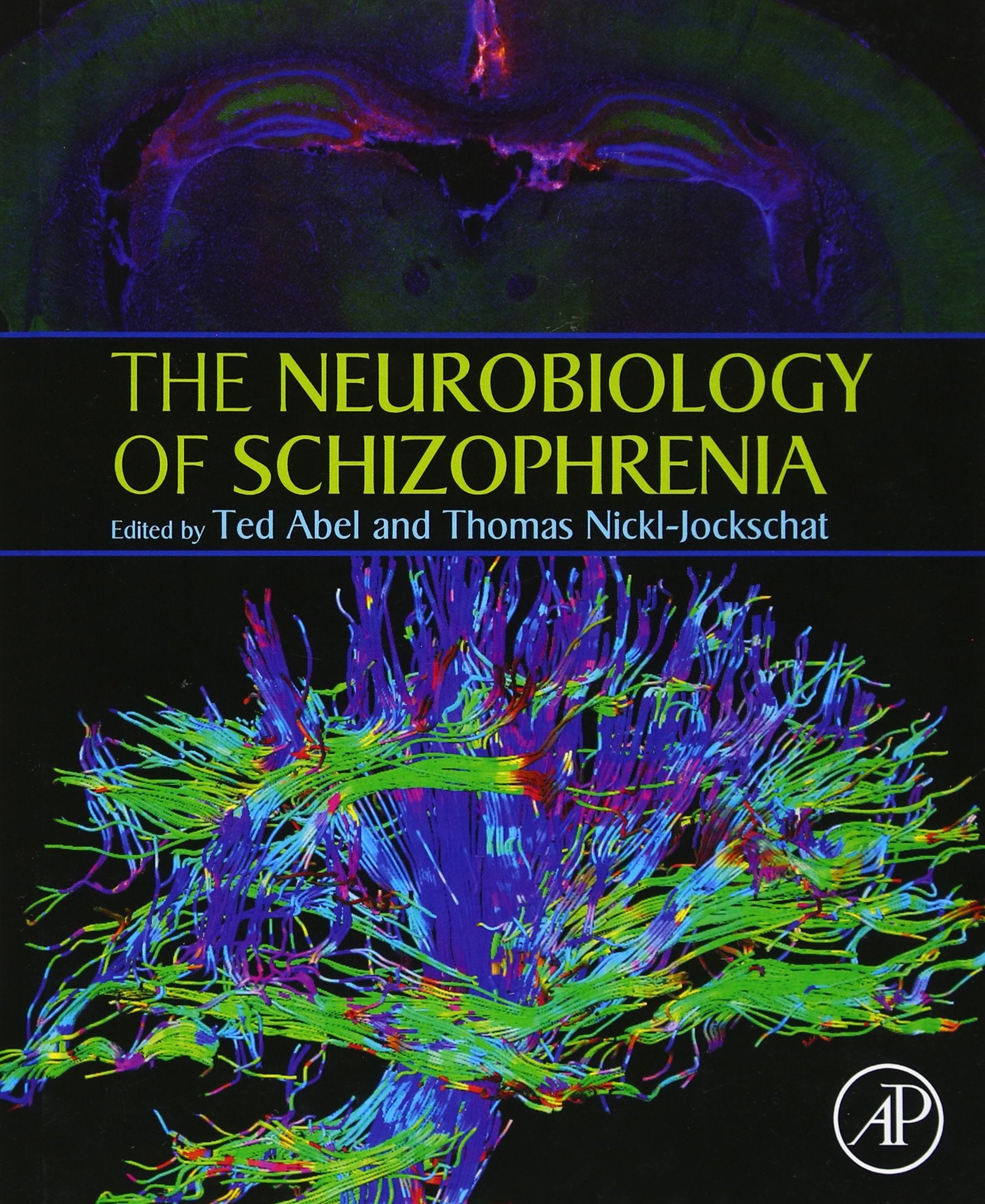 The Neurobiology of Schizophrenia,Used