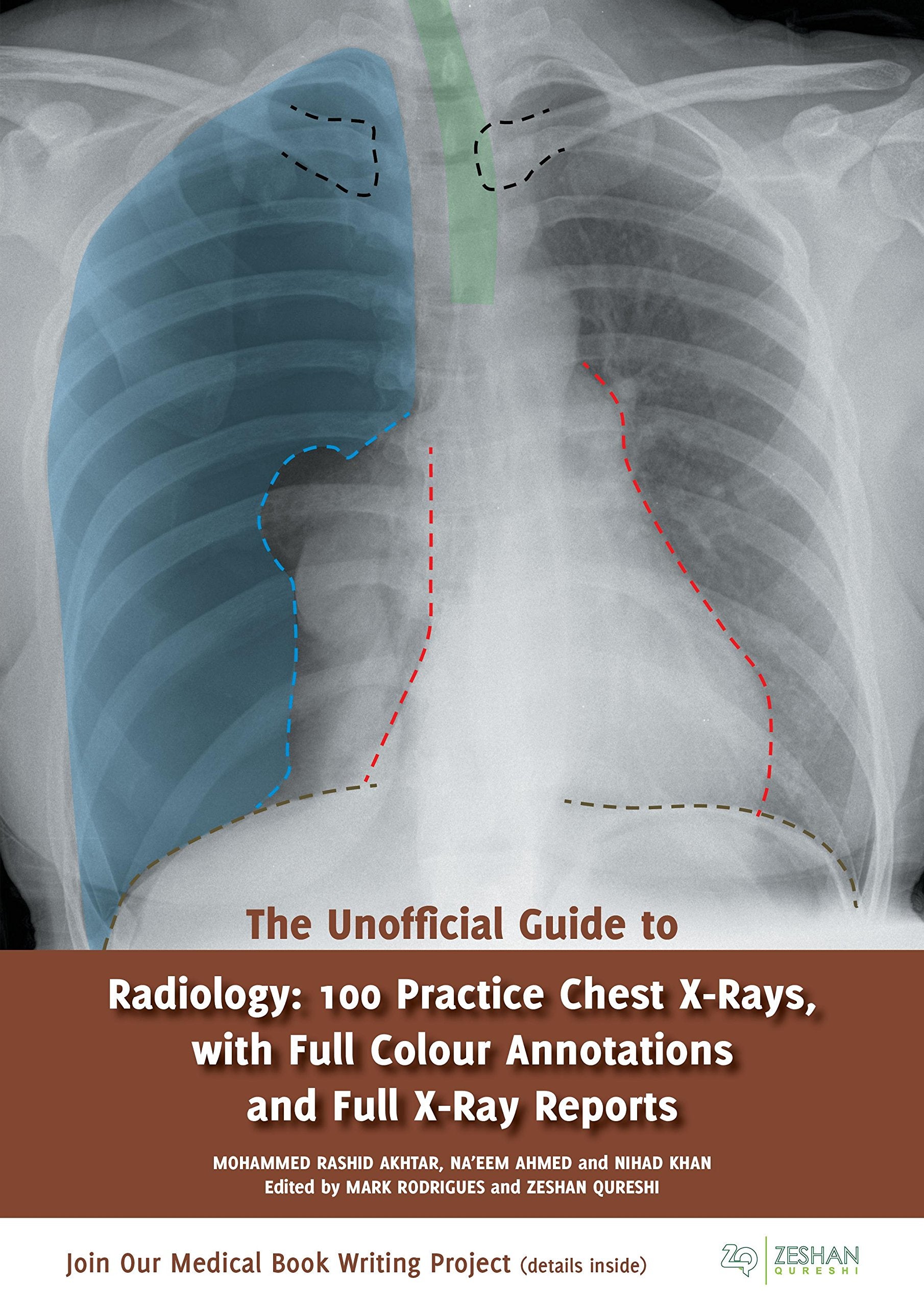 The Unofficial Guide to Radiology: 100 Practice Chest X Rays with Full Colour Annotations and Full X Ray Reports (Unofficial Gui,New