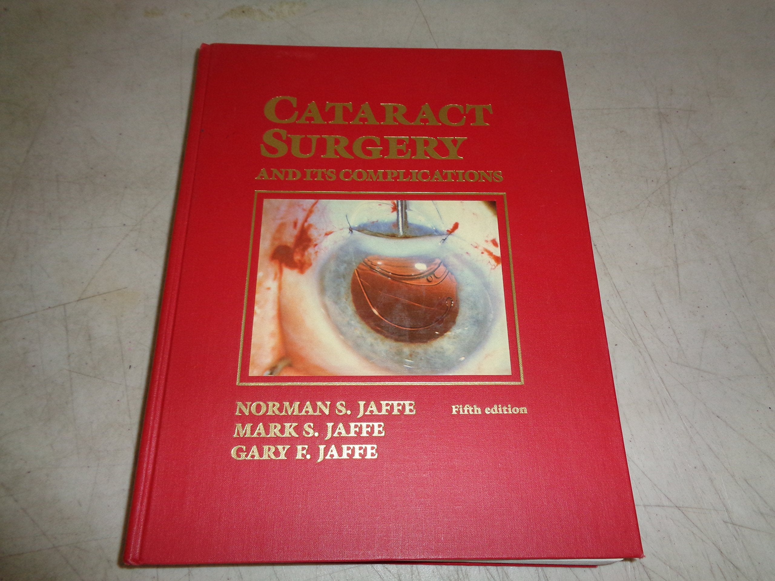 Cataract Surgery and Its Complications,Used