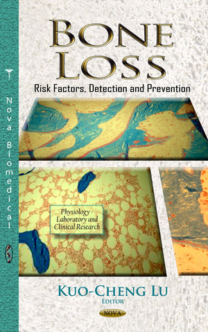 Bone Loss: Risk Factors, Detection and Prevention (Physiology  Laboratory and Clinical Research),Used