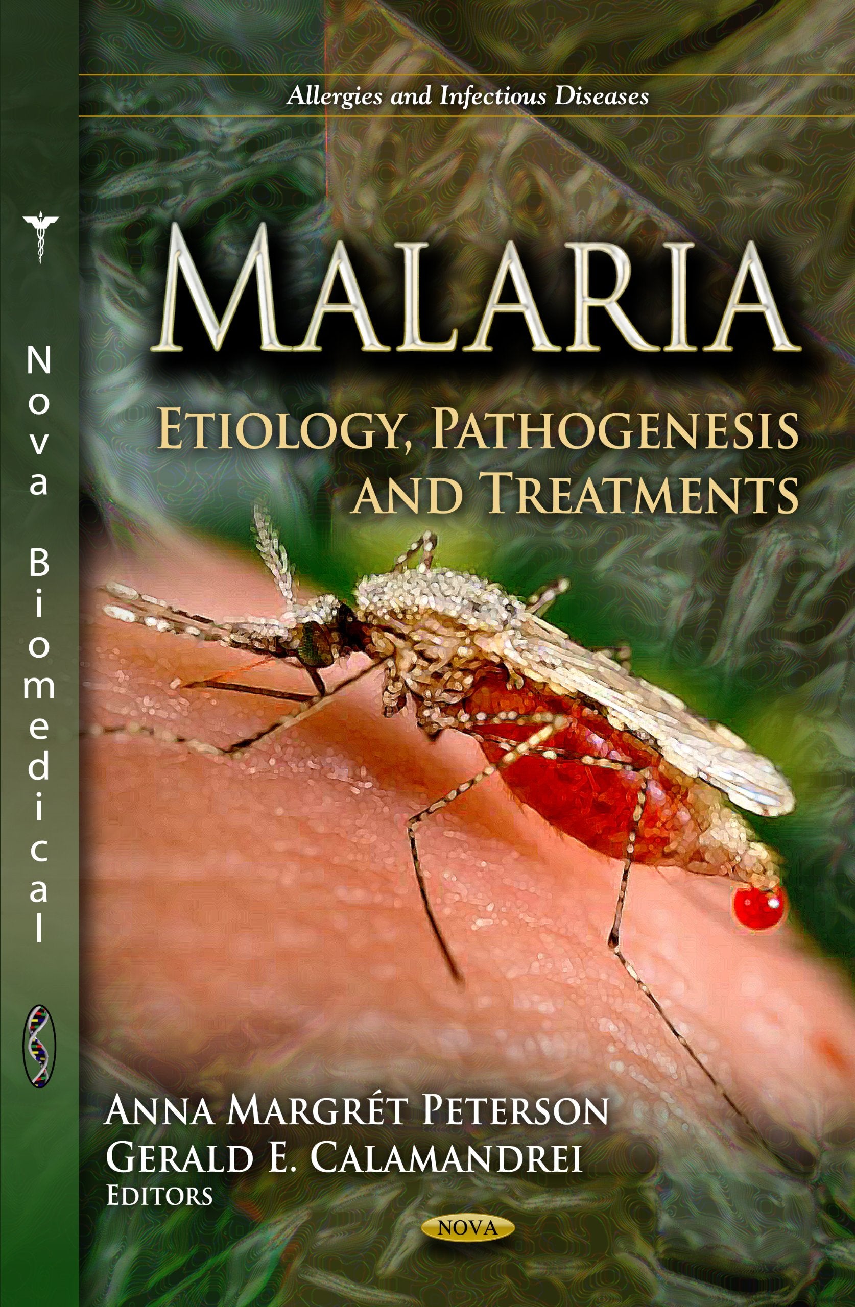 Malaria: Etiology, Pathogenesis And Treatments (Allergies And Infectious Diseases),Used