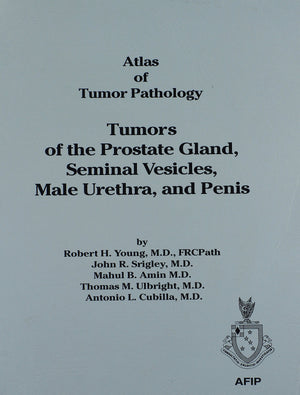 Tumors of the Prostate, Seminal Vesicles, Male Urethra and Penis: 28