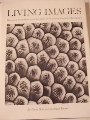 Living Images: Biological Microstructures Revealed By Scanning Electron Microscopy-used