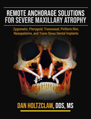 Remote Anchorage Solutions for Severe Maxillary Atrophy: Zygomatic Implants, Pterygoid Implants, Transnasal Implants, Piriform R