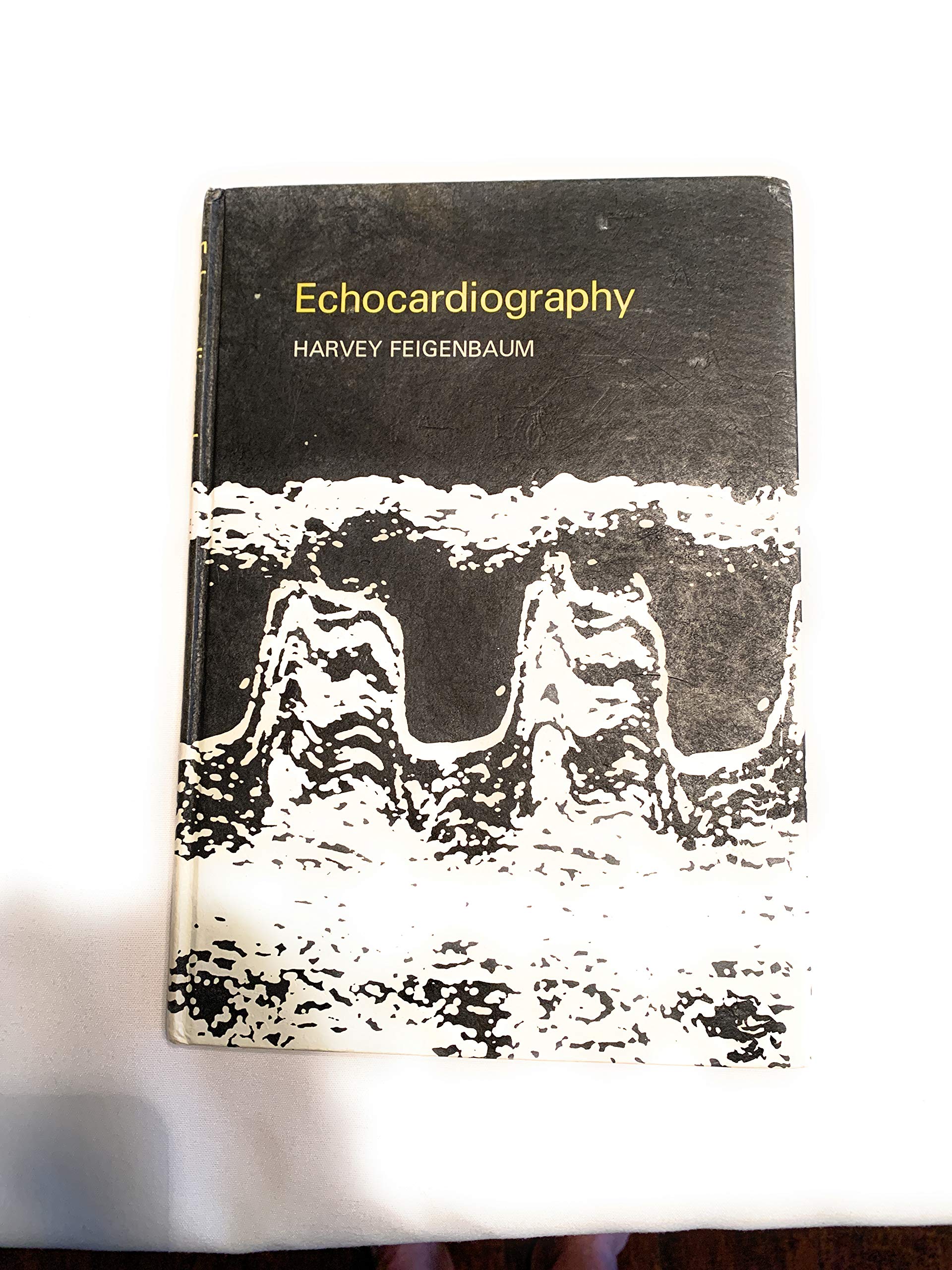 Echocardiography