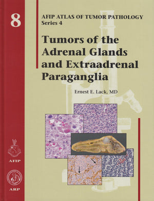 Tumors of the Adrenal Glands and Extraadrenal Paraganglia  Volume 8 (Afip Atlas of Tumor Pathology Series 4),Used