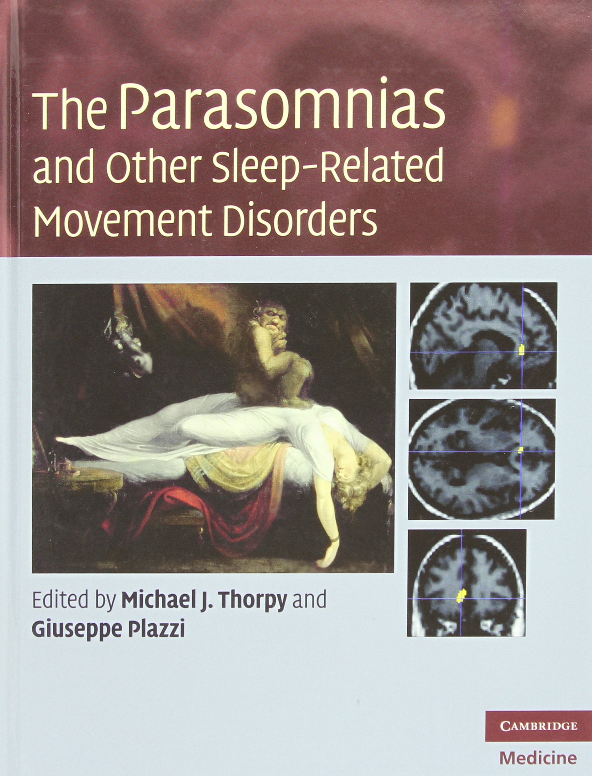 The Parasomnias and Other SleepRelated Movement Disorders (Cambridge Medicine (Hardcover)),New