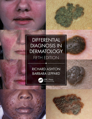 Differential Diagnosis in Dermatology,Used