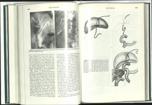 Surgery of the Gallbladder and Bile Ducts,Used
