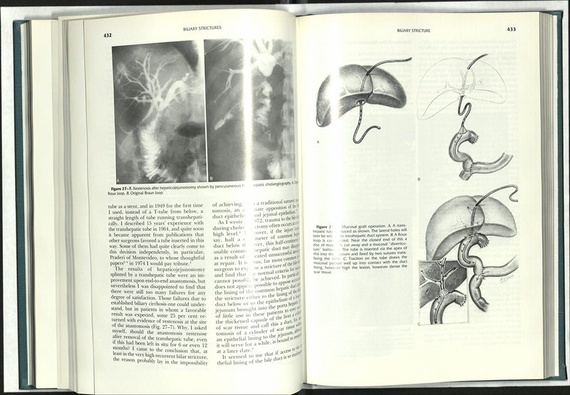 Surgery of the Gallbladder and Bile Ducts,Used