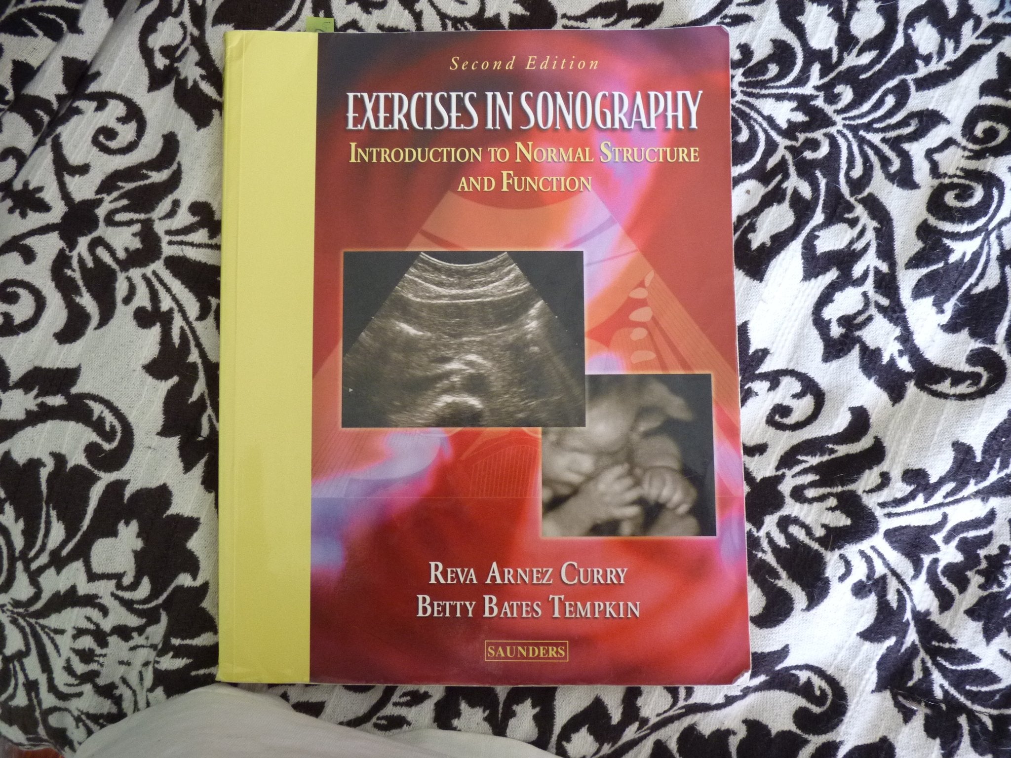 Exercises In Sonography: Introduction To Normal Structure And Function,New