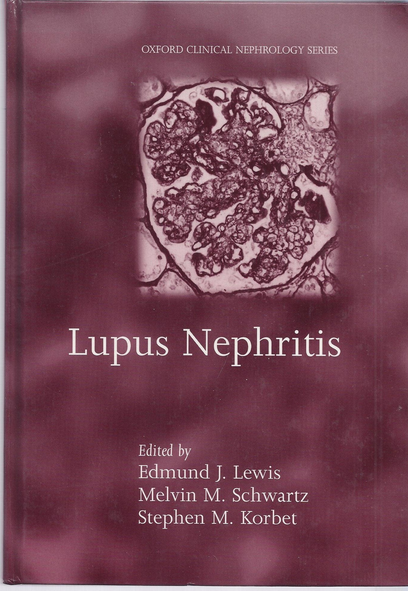 Lupus Nephritis (Oxford Clinical Nephrology Series),Used