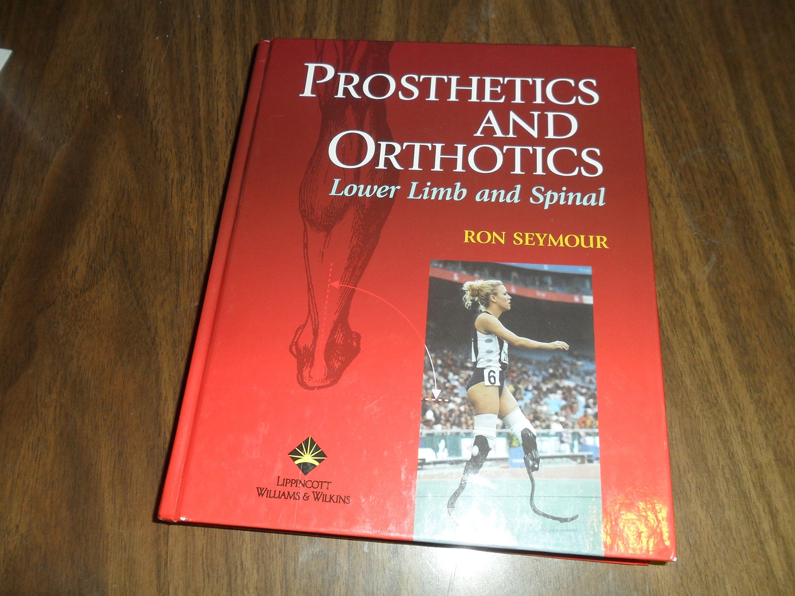 Prosthetics And Orthotics: Lower Limb And Spine