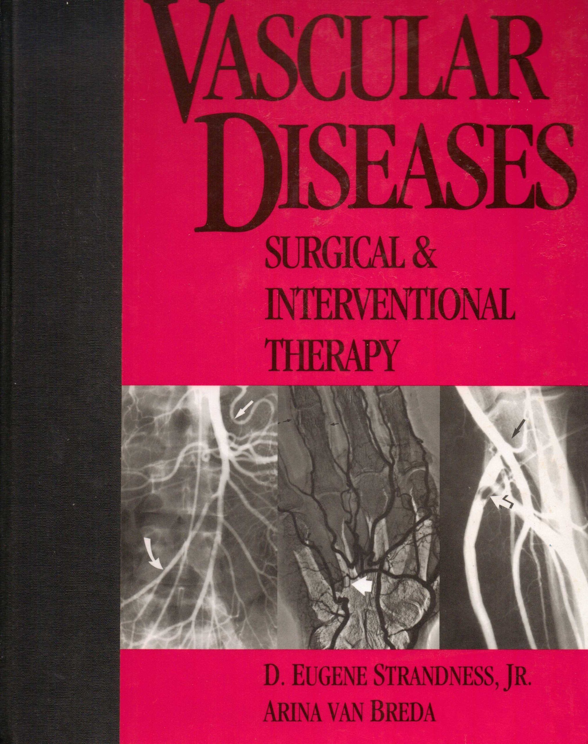 Vascular Diseases: Surgical & Interventional Therapy,Used
