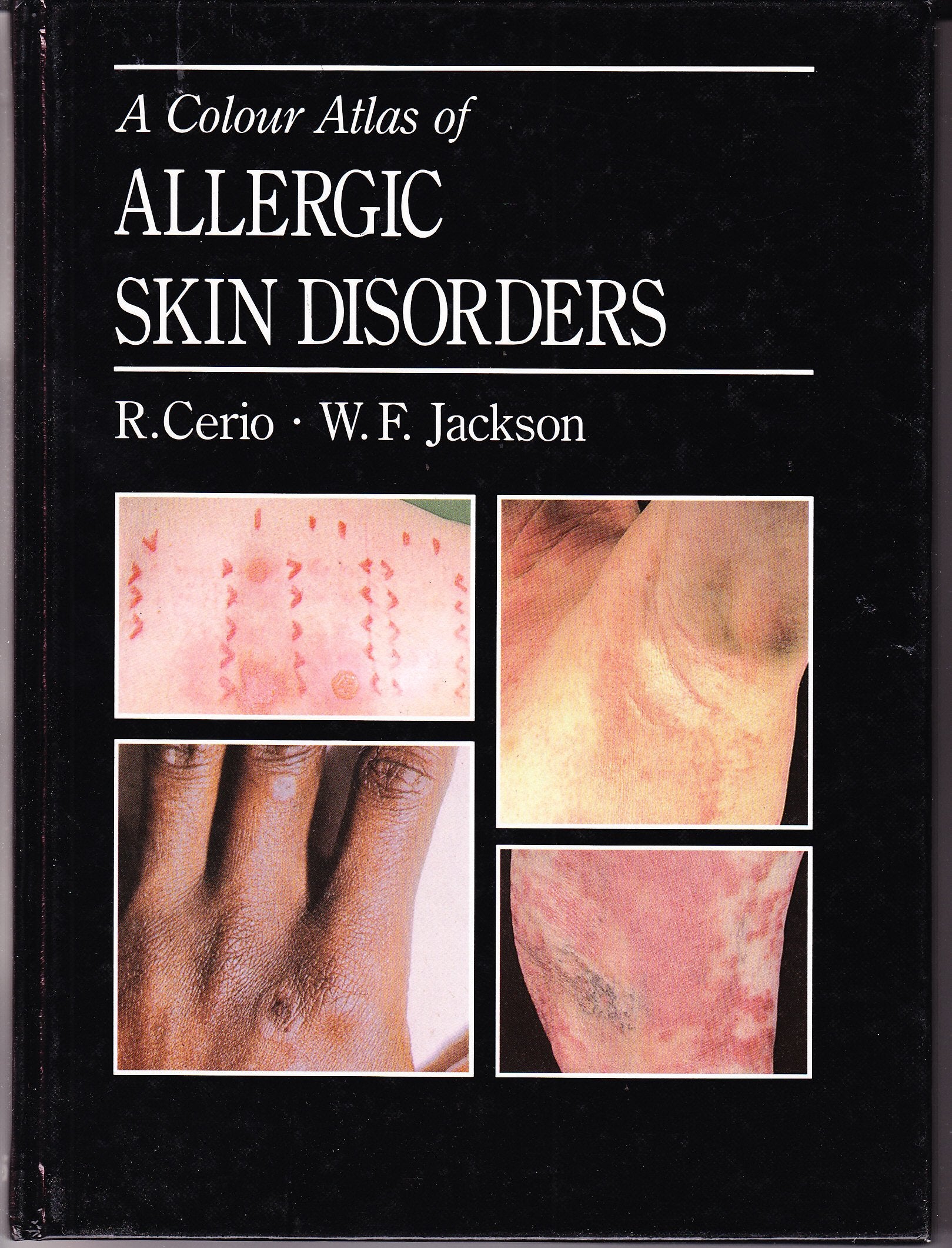 Colour Atlas Of Allergic Skin Disorders,Used