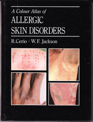 Colour Atlas Of Allergic Skin Disorders,Used
