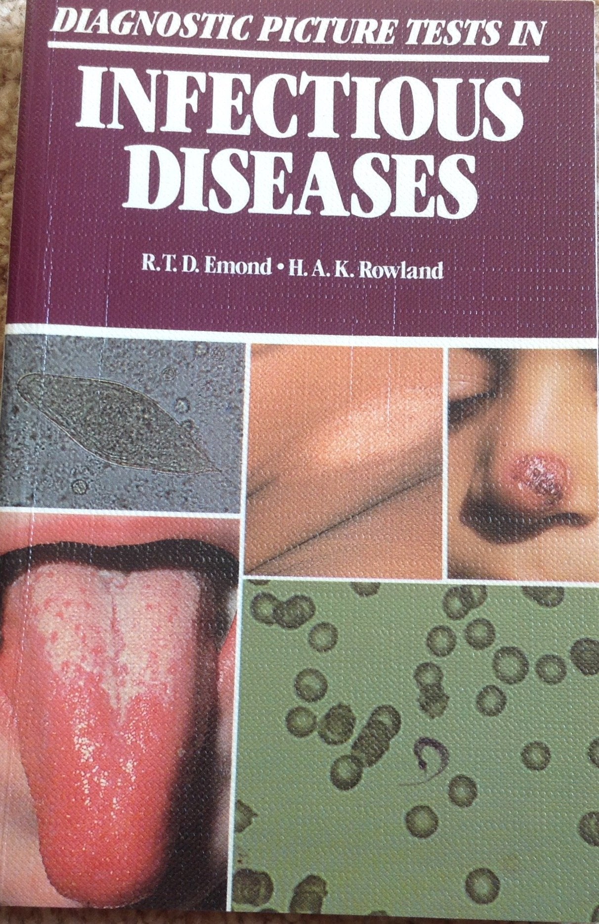 Diagnostic Picture Tests in Infectious Diseases,Used