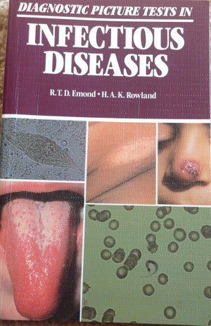 Diagnostic Picture Tests in Infectious Diseases,Used
