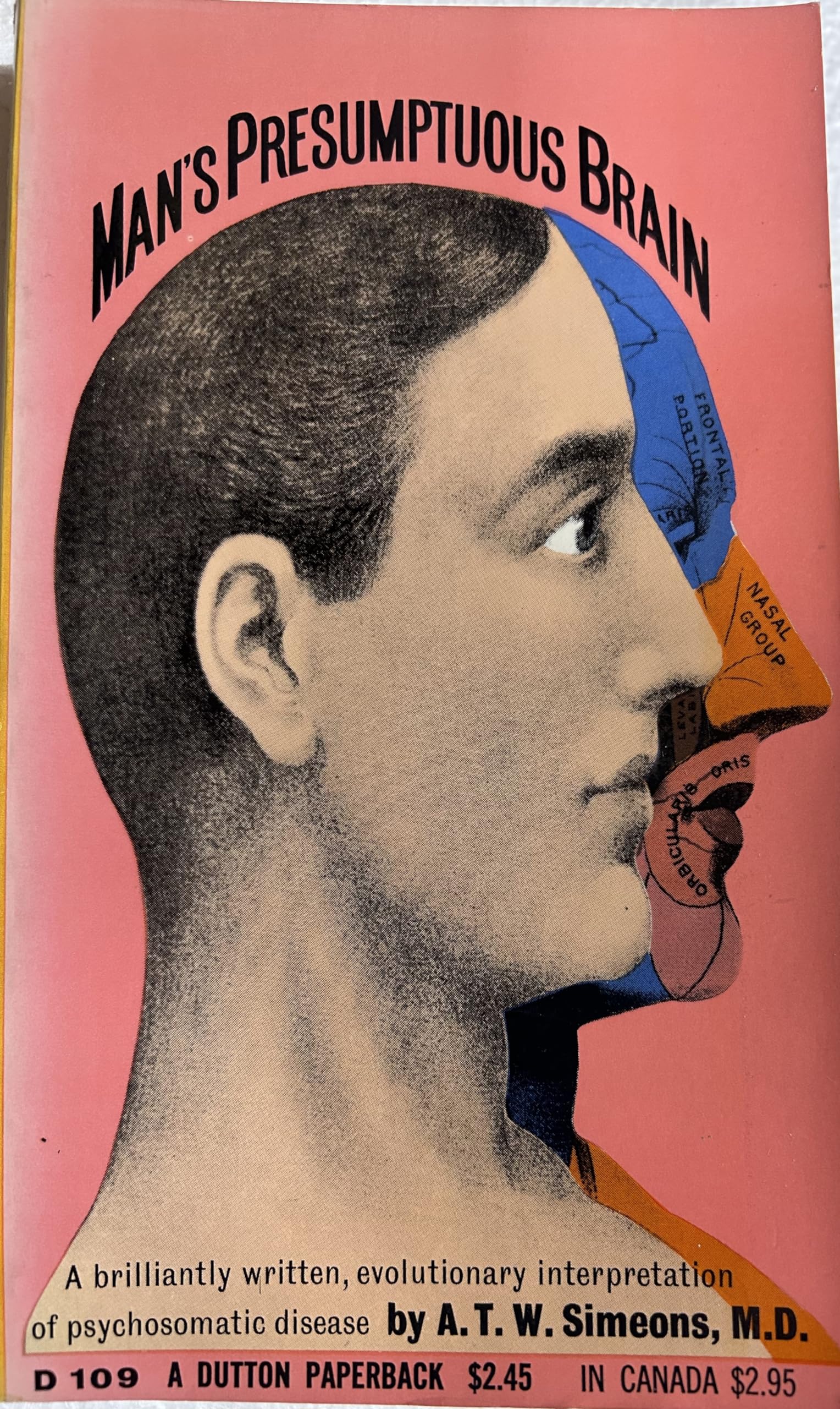 Man'S Presumptuous Brain