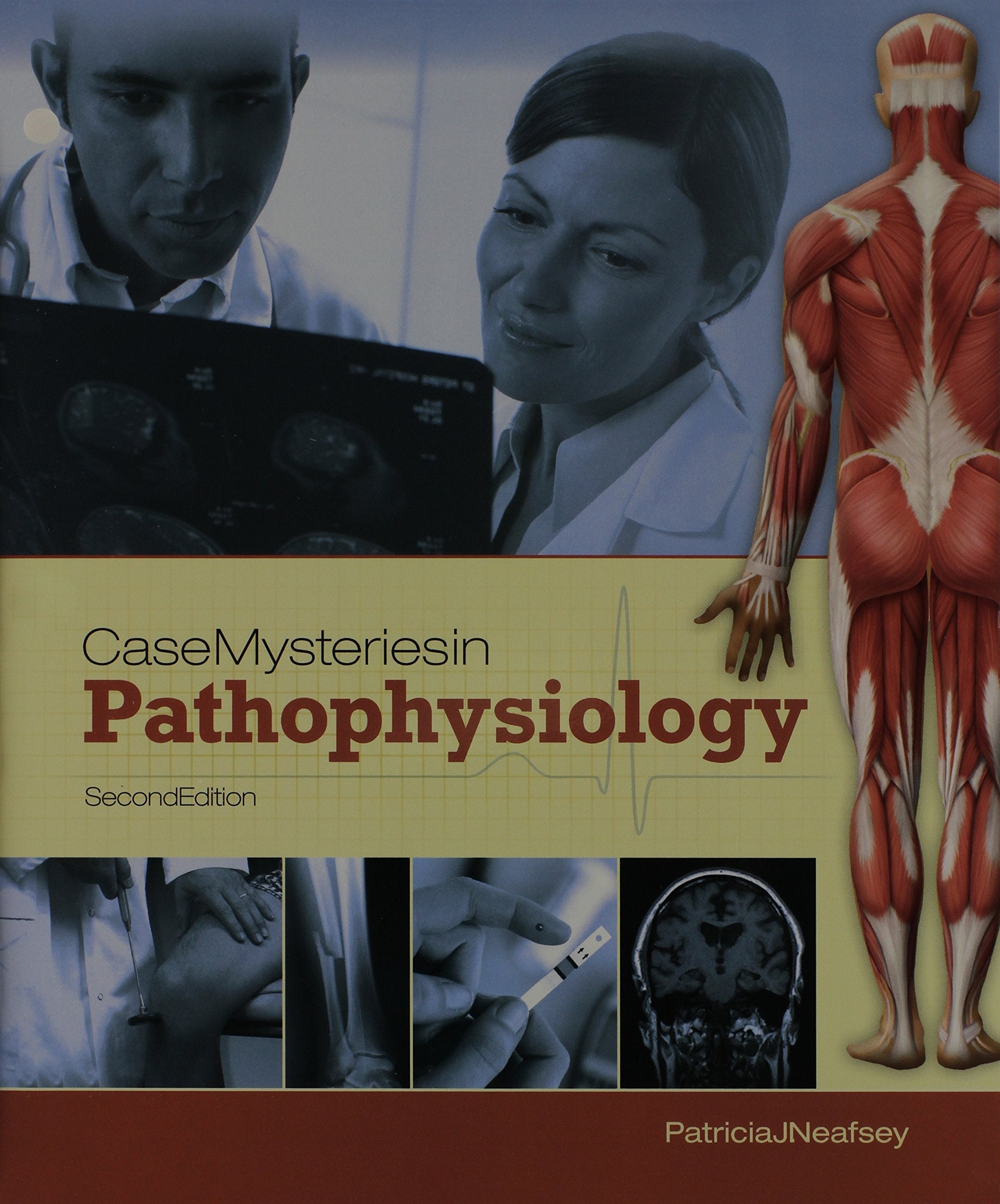 Case Mysteries in Pathophysiology,Used