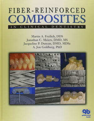Fiberreinforced Composites In Clinical Dentistry,Used