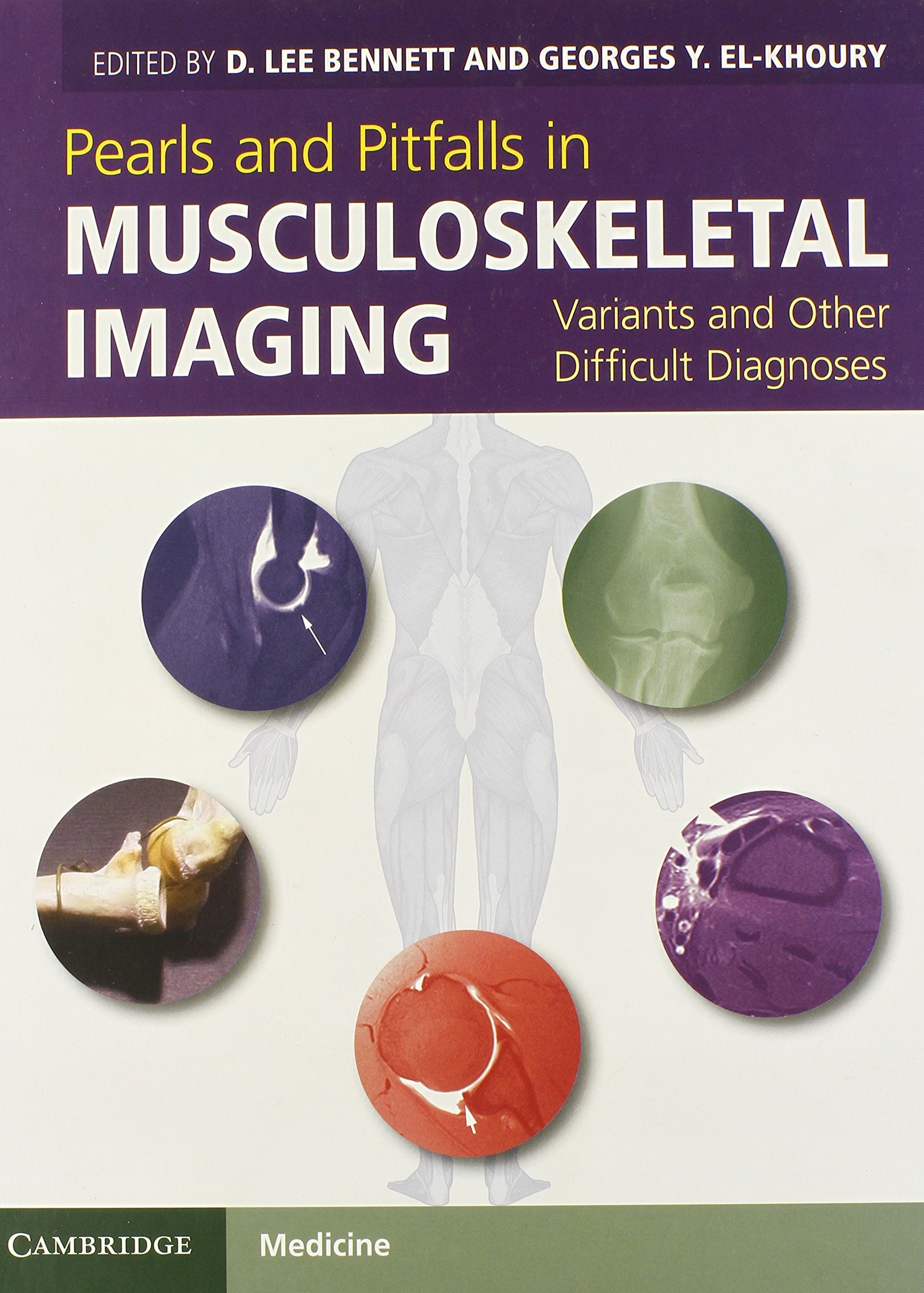 Pearls and Pitfalls in Musculoskeletal Imaging: Variants and Other Difficult Diagnoses,Used