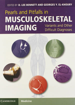 Pearls and Pitfalls in Musculoskeletal Imaging: Variants and Other Difficult Diagnoses,Used