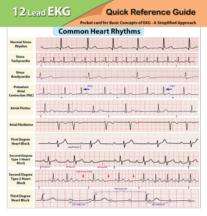 12 Lead EKG Pocket Card,Used