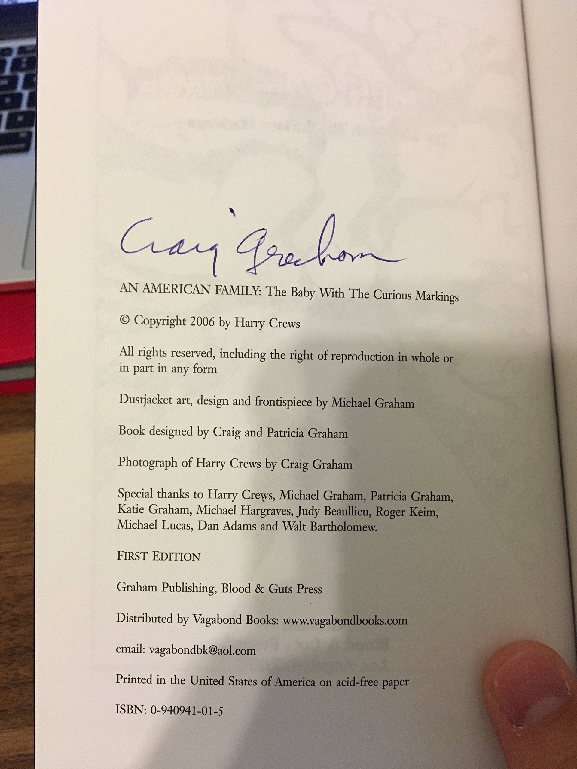 An American Family: The Baby With The Curious Markings,New