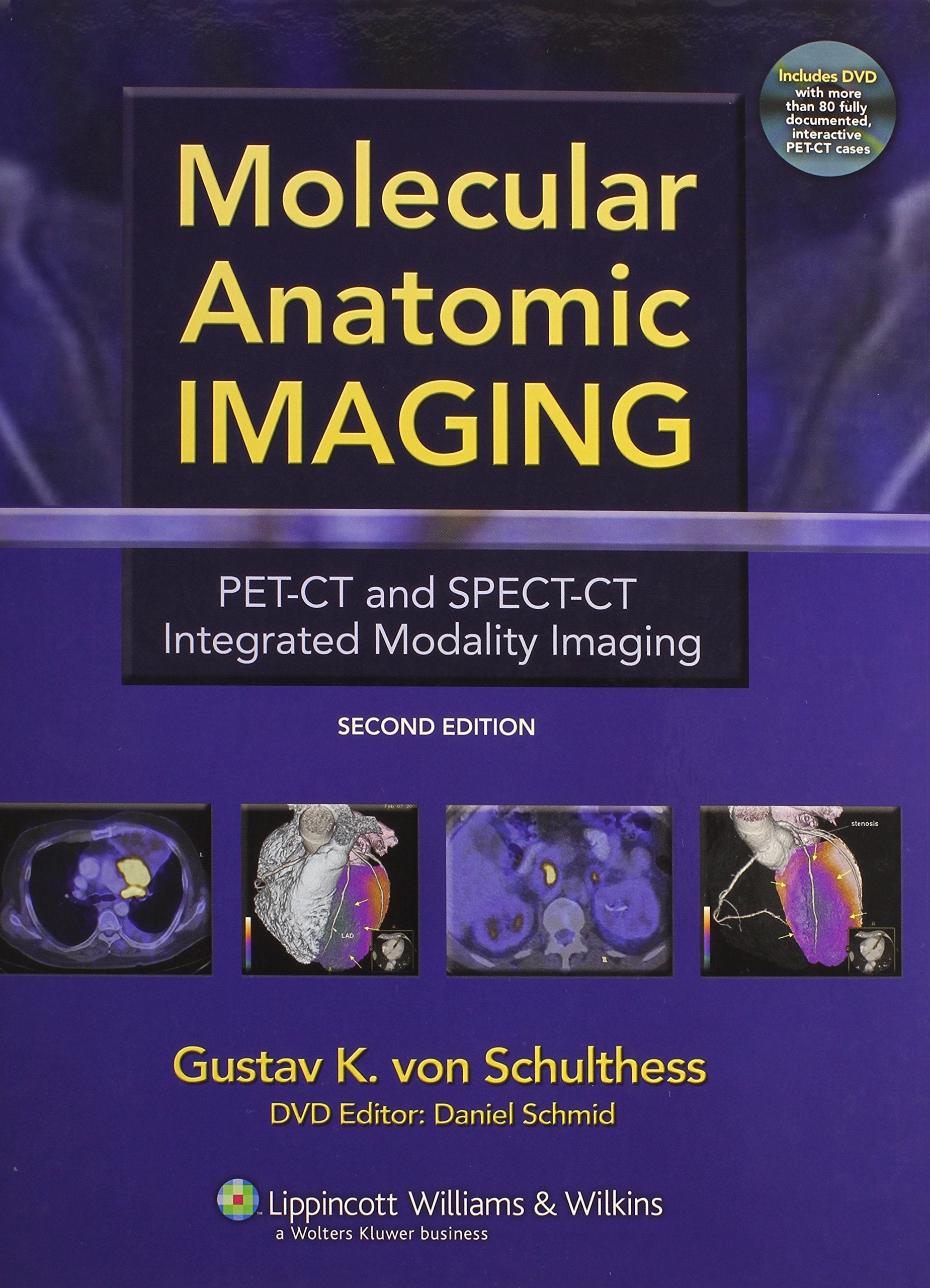 Molecular Anatomic Imaging: PETCT And SPECTCT Integrated Modality Imaging,Used