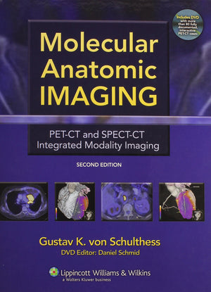 Molecular Anatomic Imaging: PETCT And SPECTCT Integrated Modality Imaging,Used