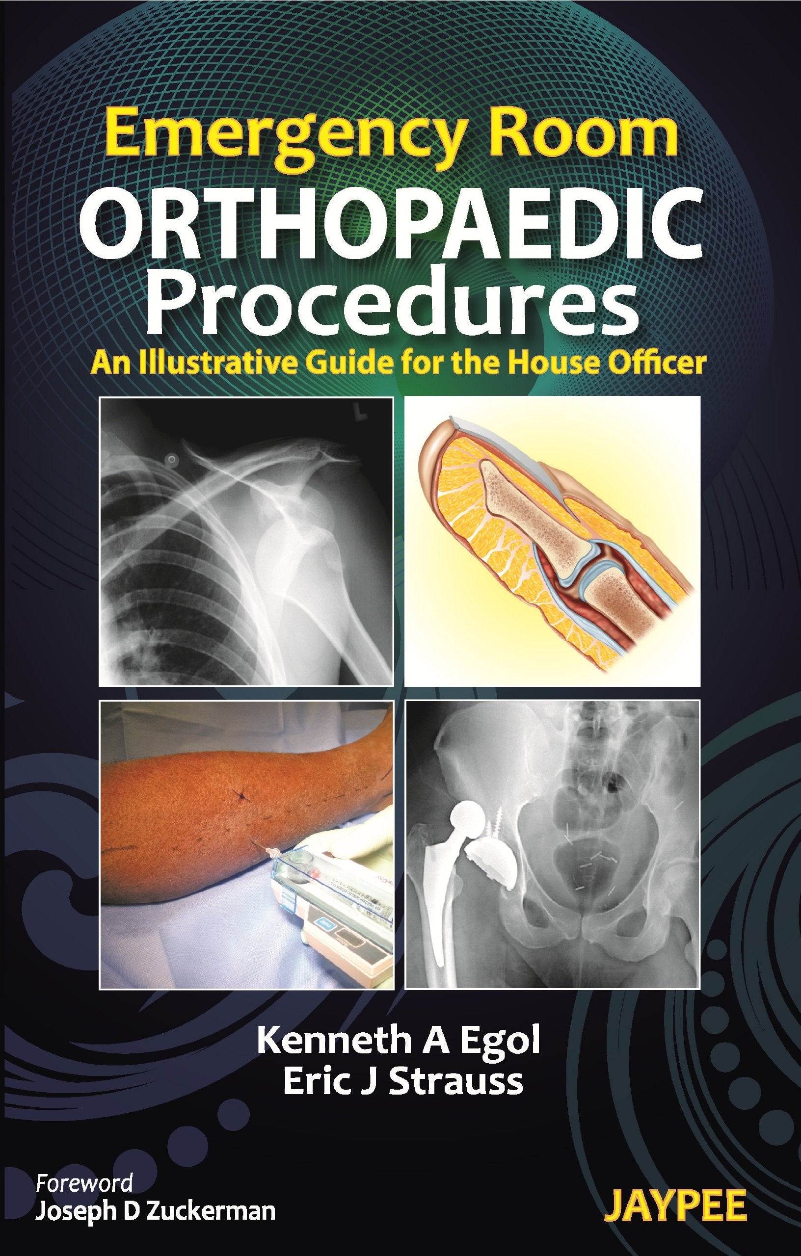 Emergency Room Orthopaedic Procedures: An Illustrative Guide For The House Officer