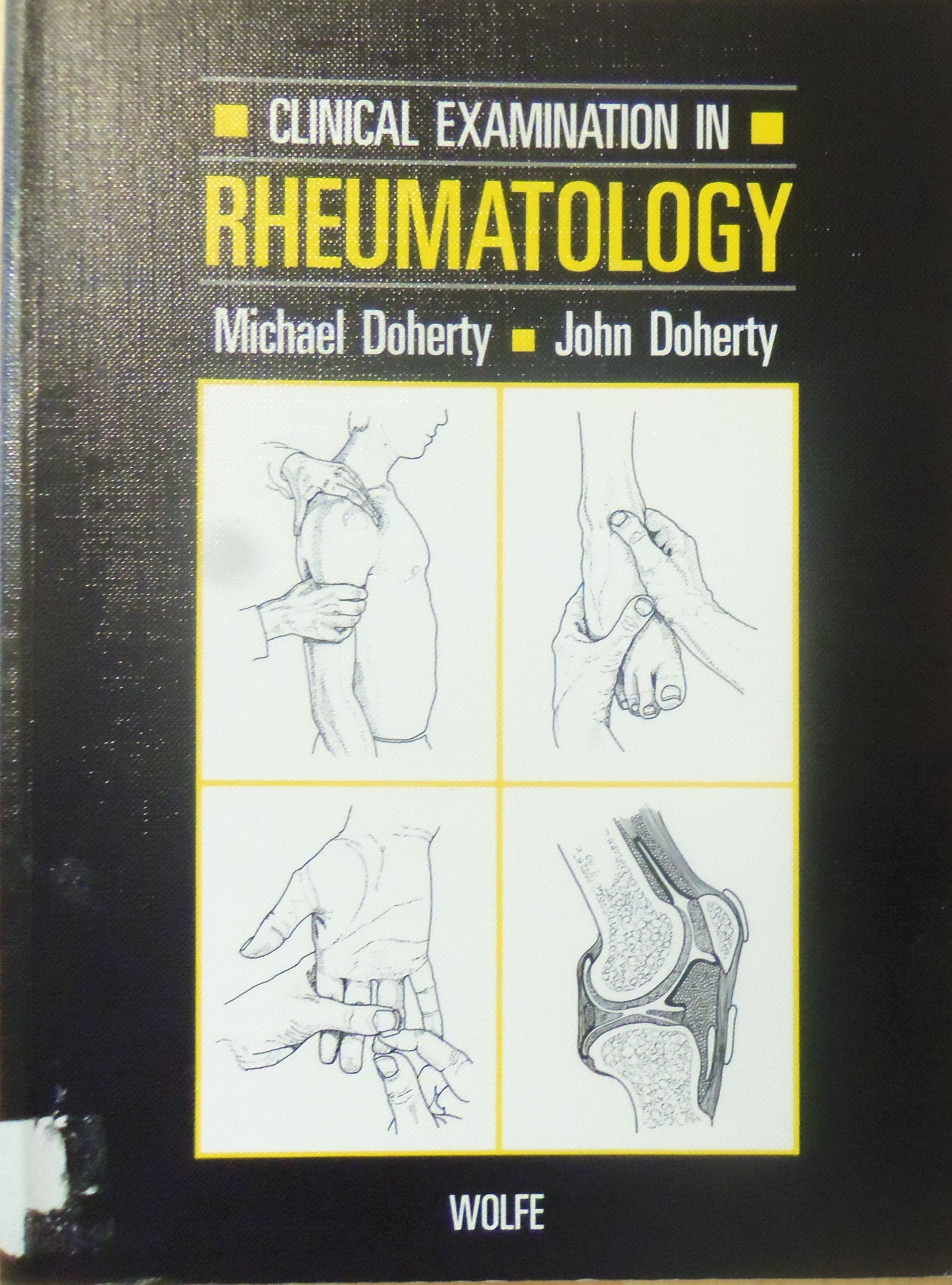 Clinical examination in rheumatology,Used