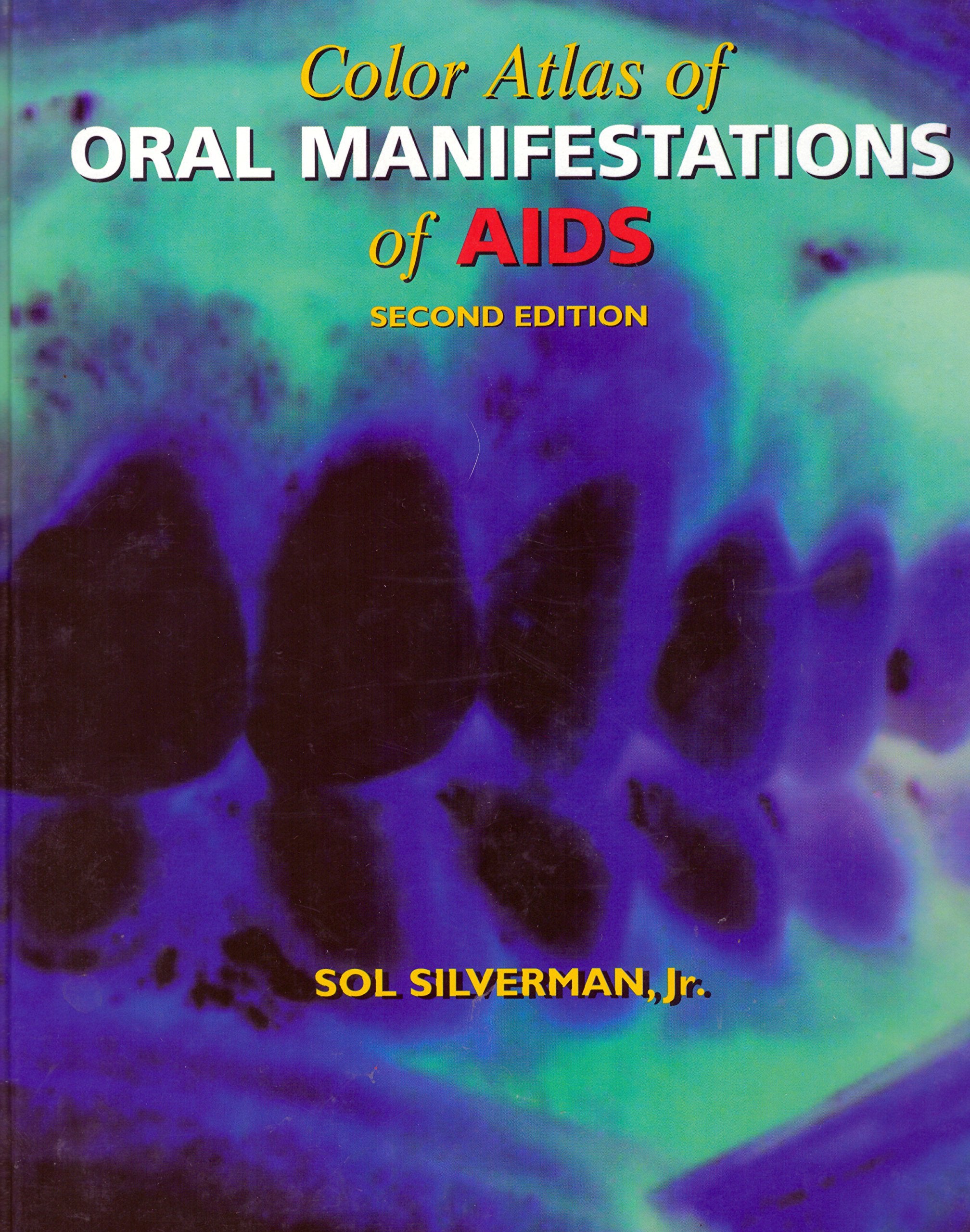 Color Atlas Of Oral Manifestations Of Aids,Used
