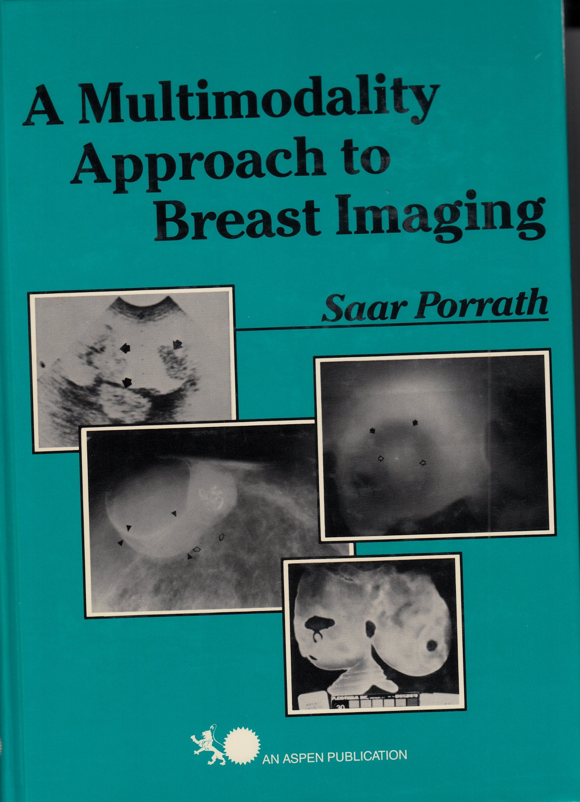A Multimodality Approach to Breast Imaging