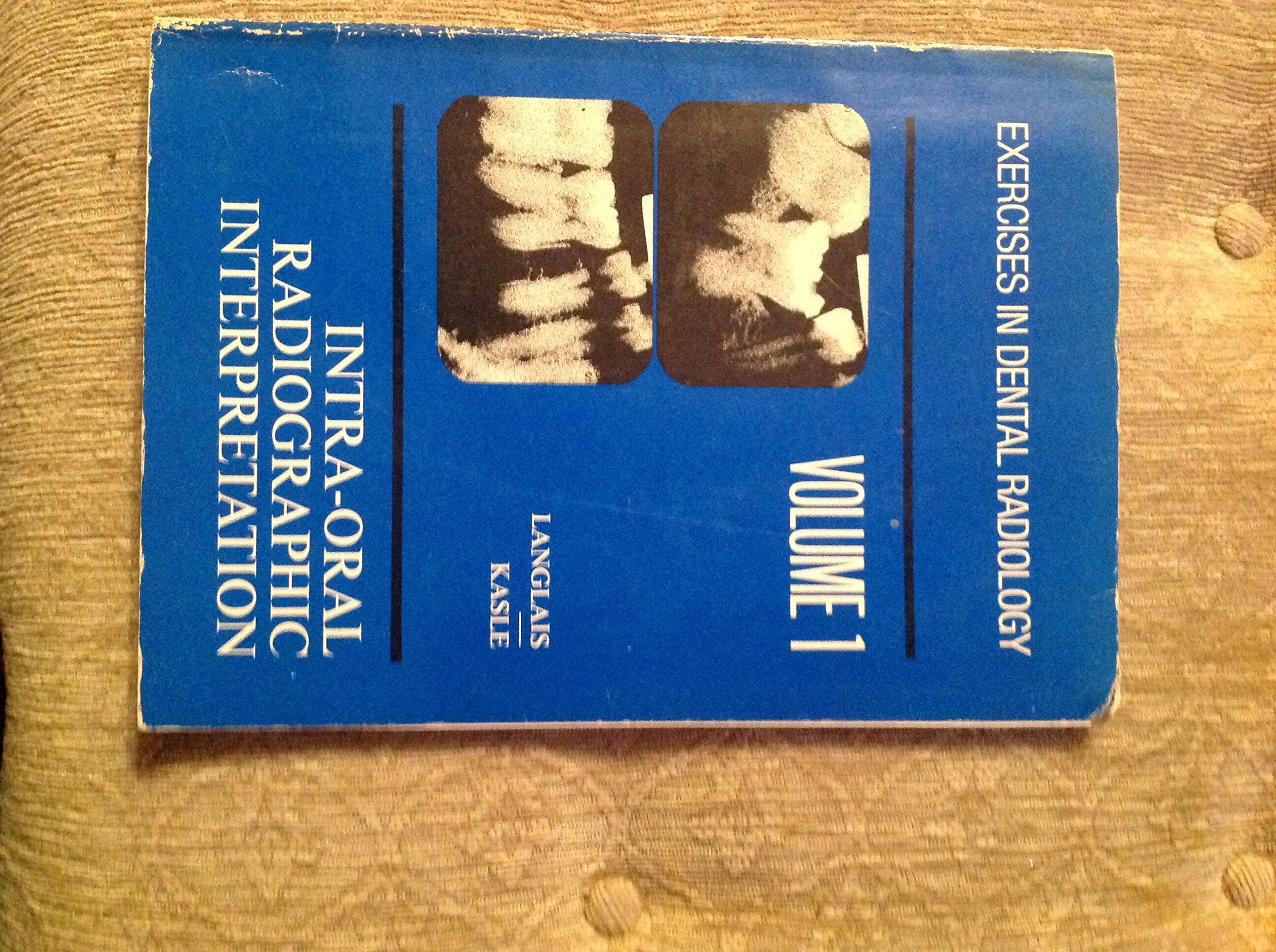 IntraOral Radiographic Interpretation,Used