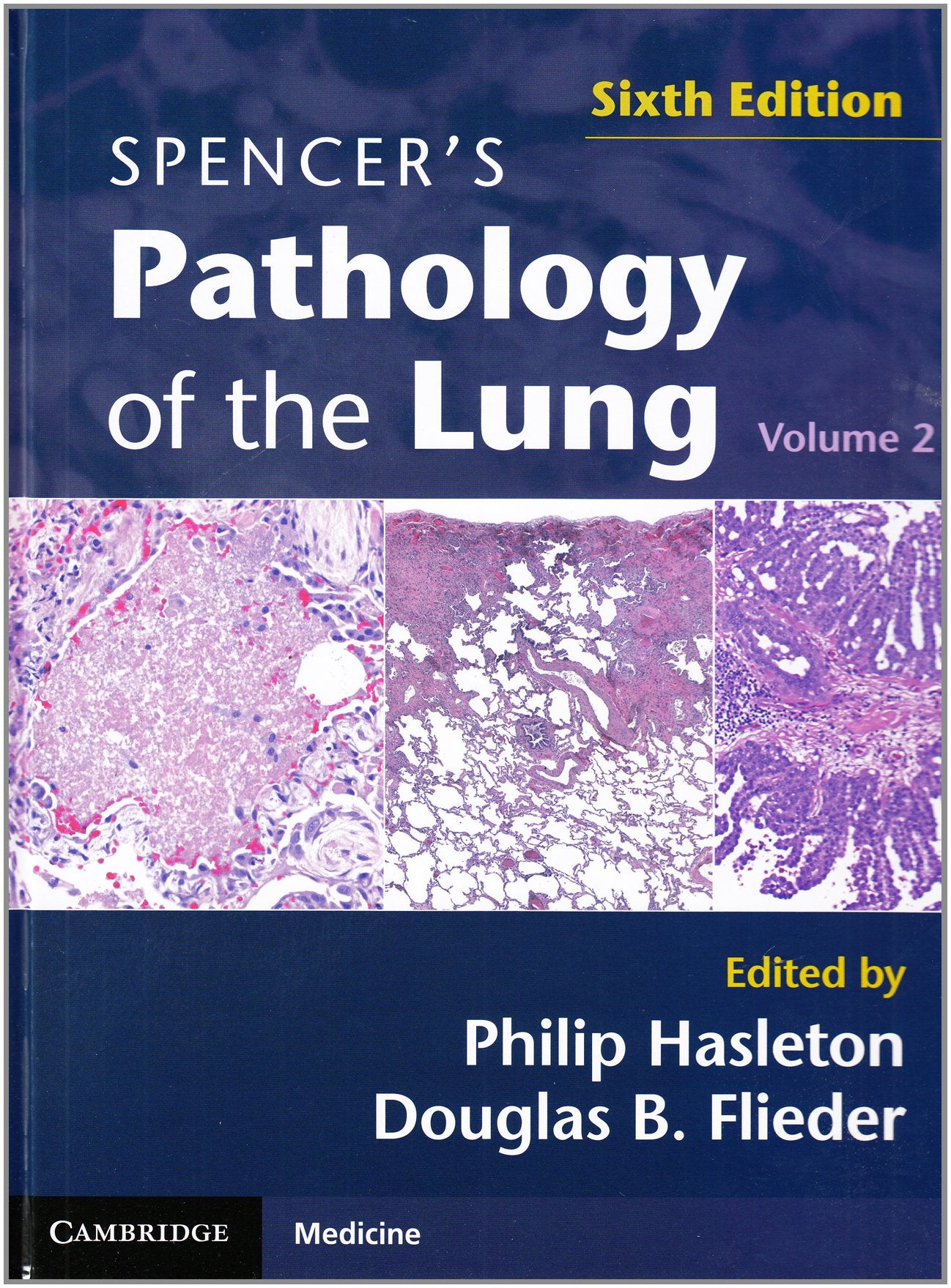 Spencer's Pathology of the Lung 2 Part Set with DVDs,New