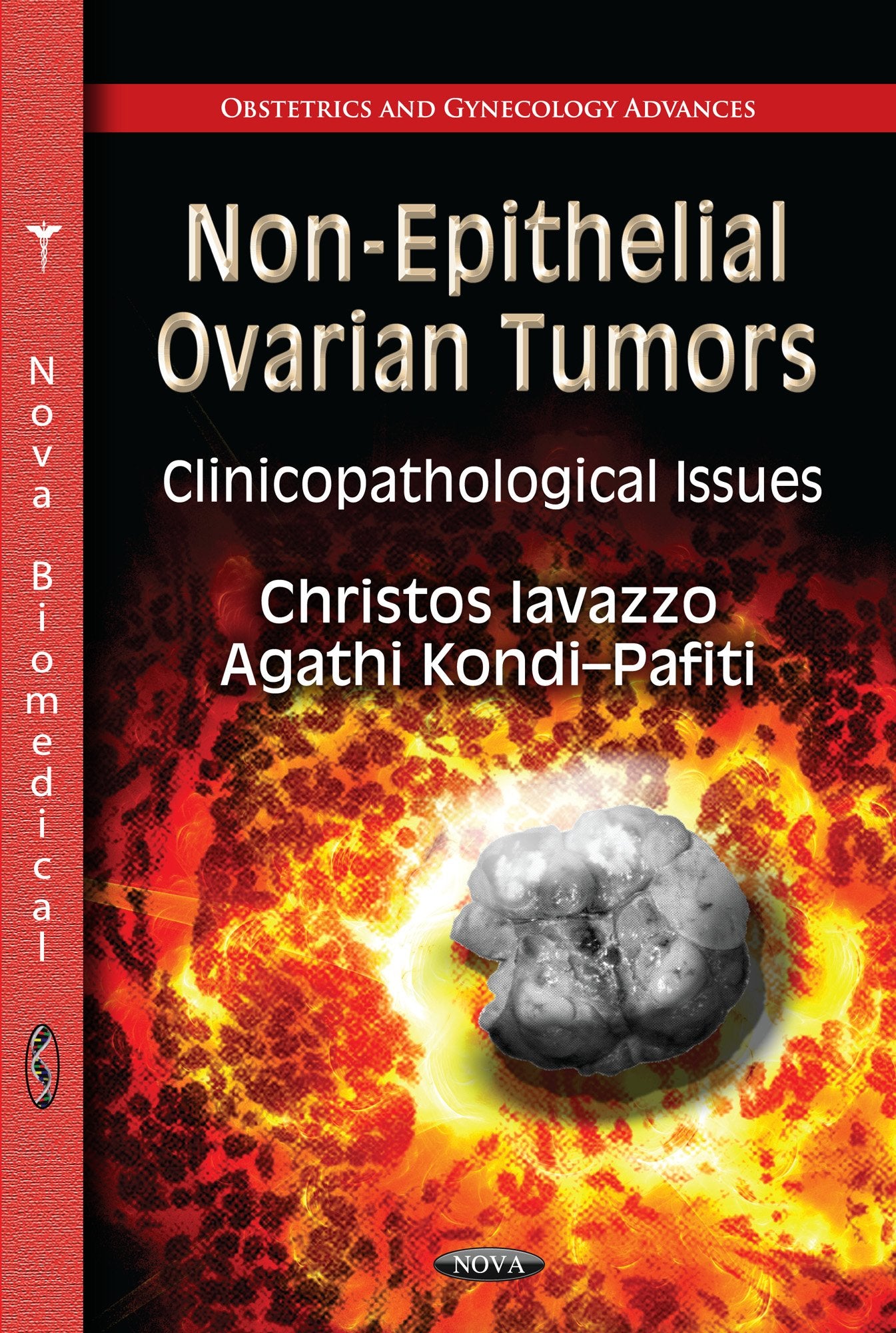 Nonepithelial Ovarian Tumors: Clinicopathological Issues (Obstetrics And Gynecology Advances),Used