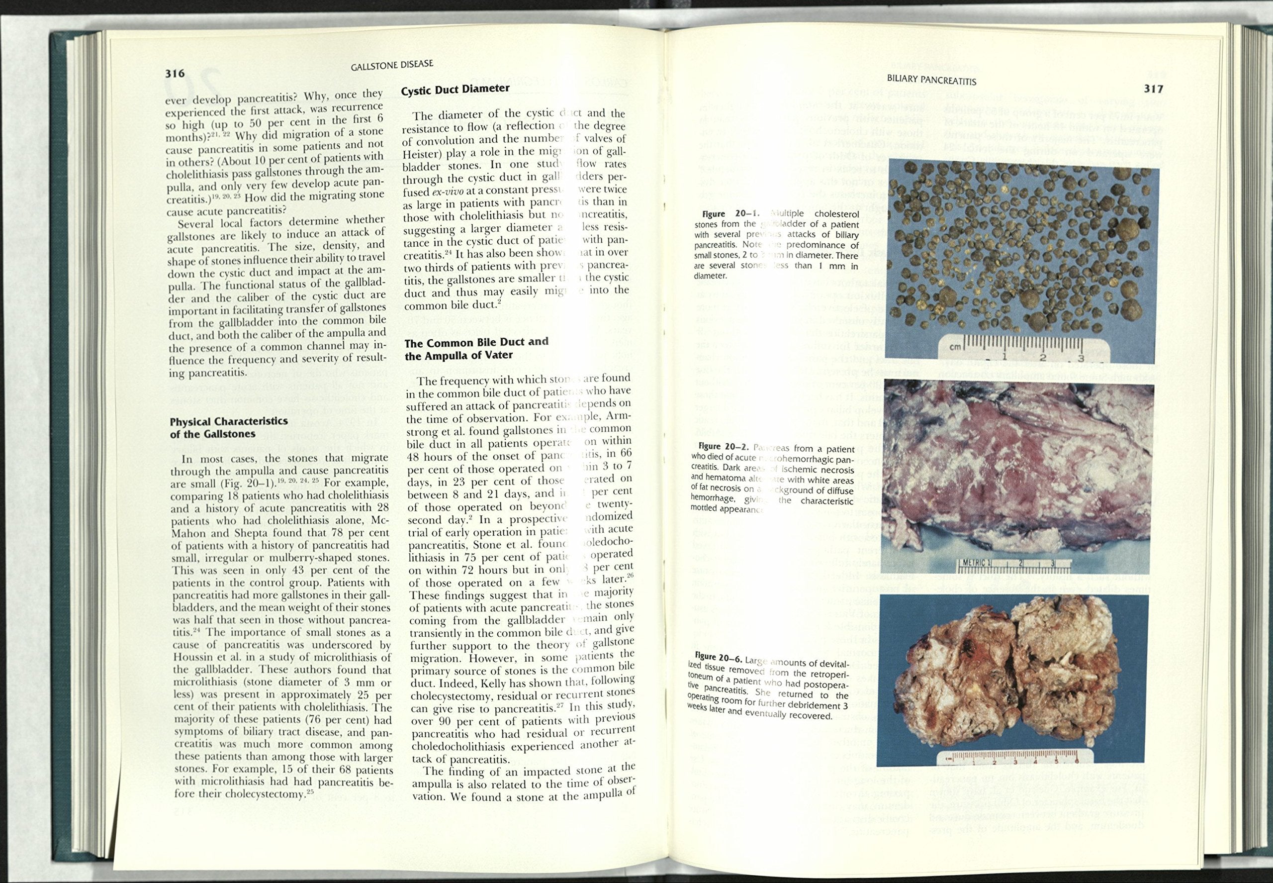 Surgery of the Gallbladder and Bile Ducts,Used