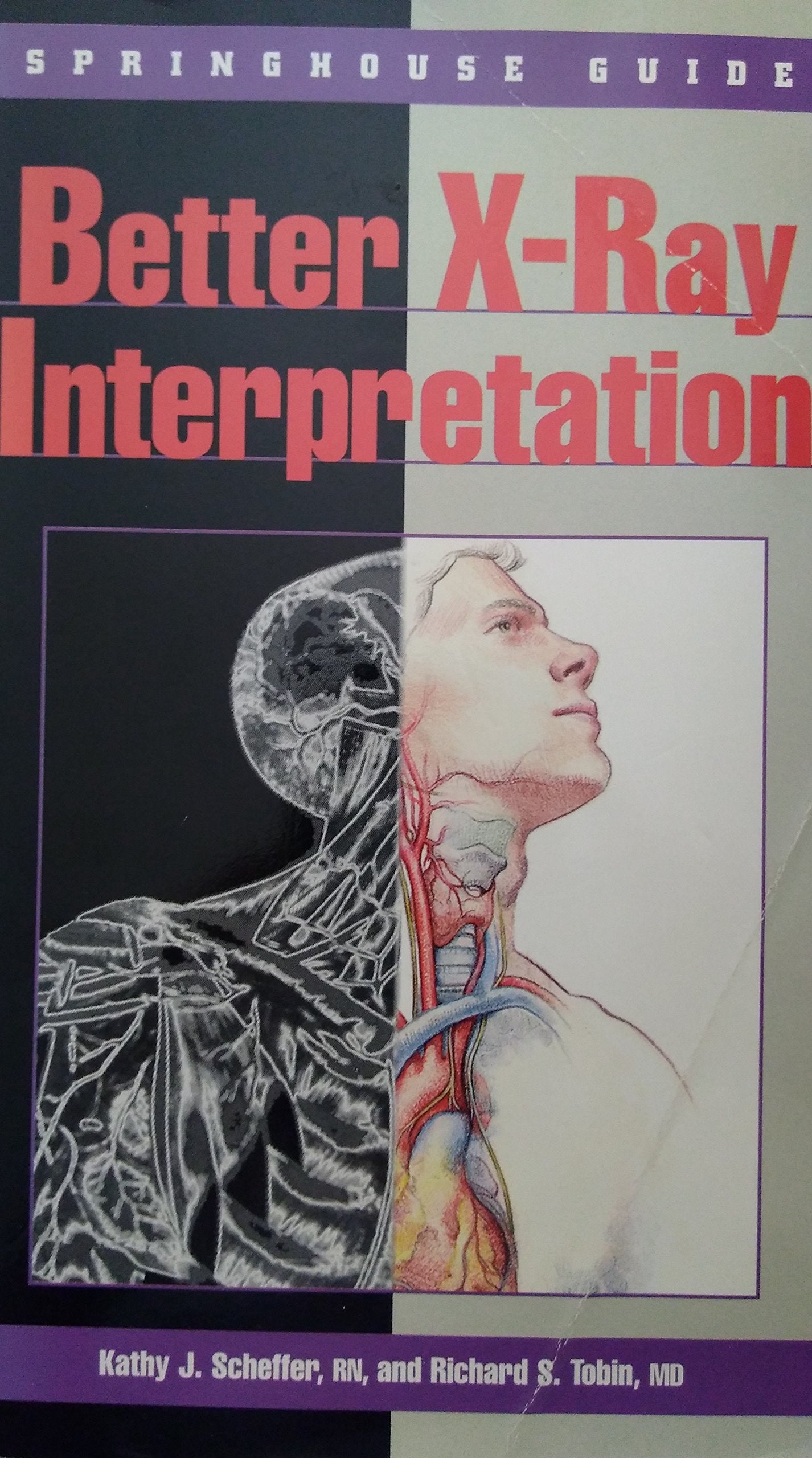Better XRay Interpretation,Used