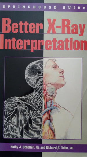 Better XRay Interpretation,Used