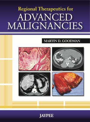 Regional Therapeutics for Advanced Malignancies,Used