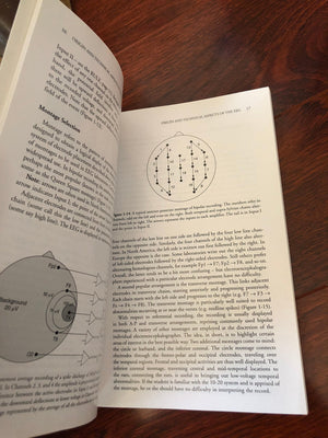 Primer of EEG: With A MiniAtlas,Used